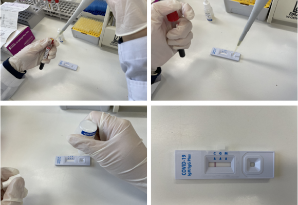 코로나19 항체검사기관 지정 및  COVID-19 항체검사 실시